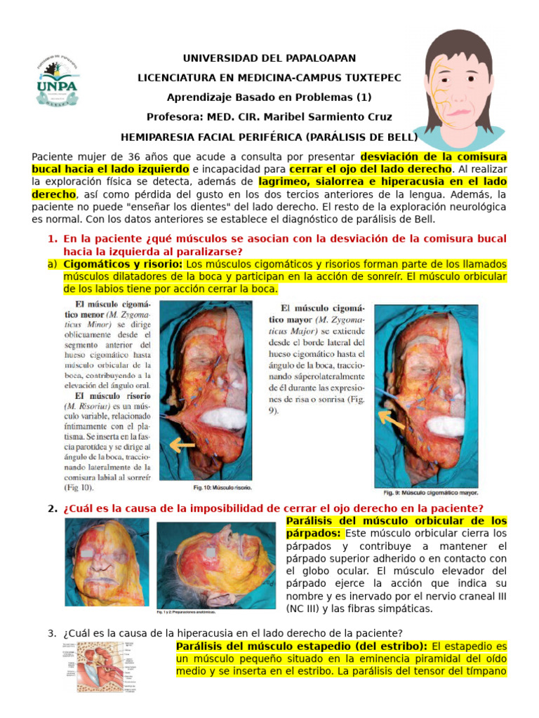 Hemiparesia Facial Diagn stico Y Causas PDF Anatom a Humana 