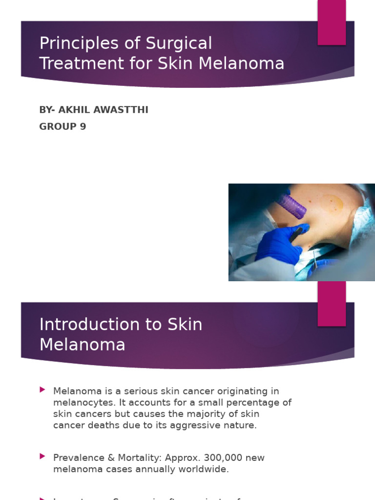 Principles of Surgical Treatment For Skin Melanoma | PDF | Melanoma ...