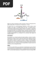 El ECG