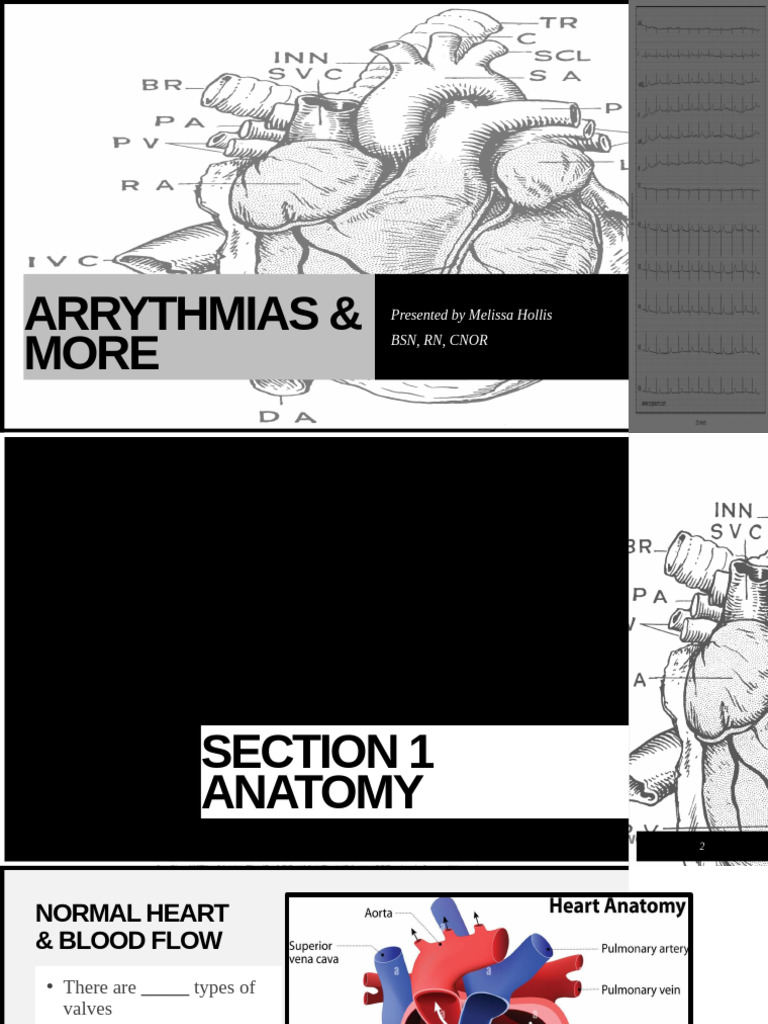 Rhythm Class Student Workbook | PDF | Artificial Cardiac Pacemaker | Electrocardiography