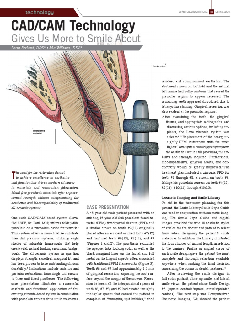 Lava Cad Cam Technology | Dentistry Branches | Dentistry