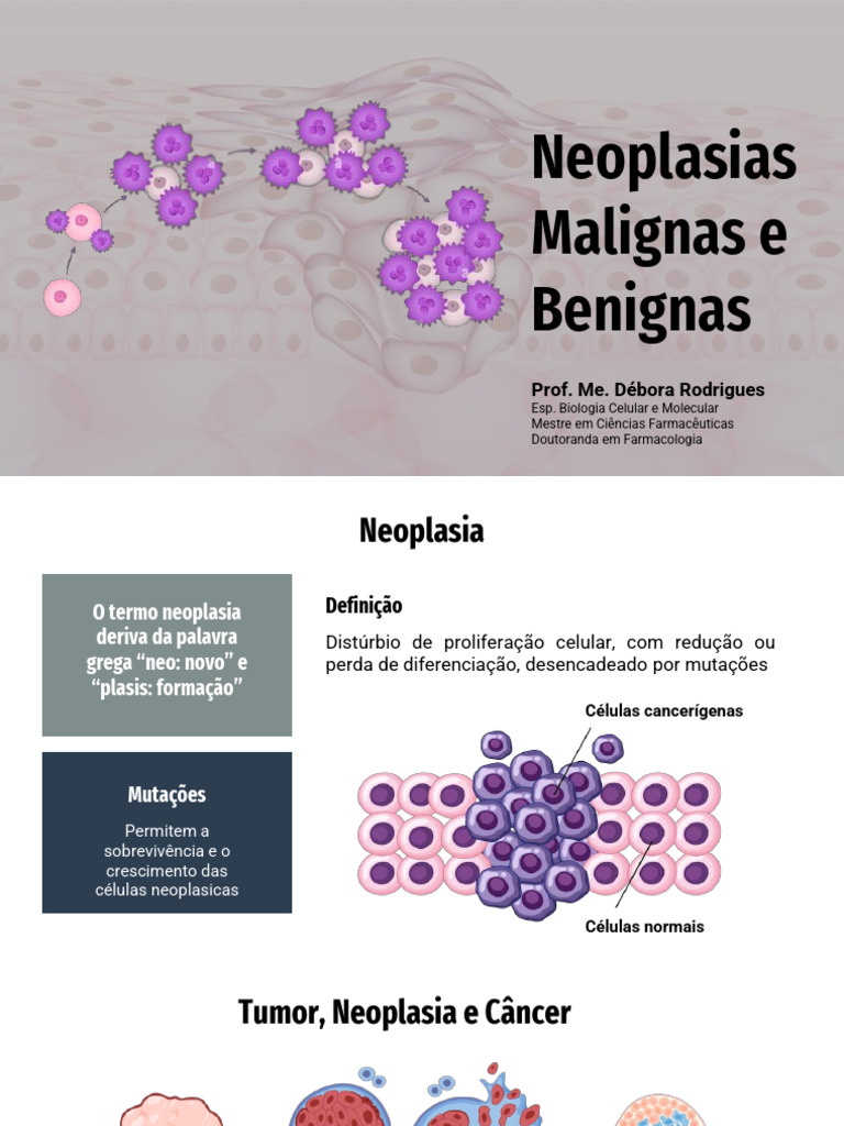 A8 l Neoplasias Malignas e Benignas | PDF | Câncer | Carcinogênese
