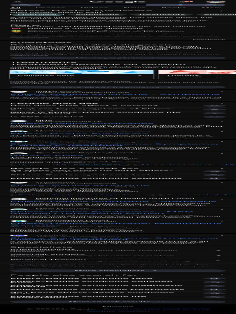 Eds Syndrome Google Search Pdf Rheumatology Clinical Medicine