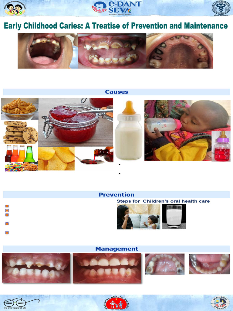 Early Childhood Caries | PDF