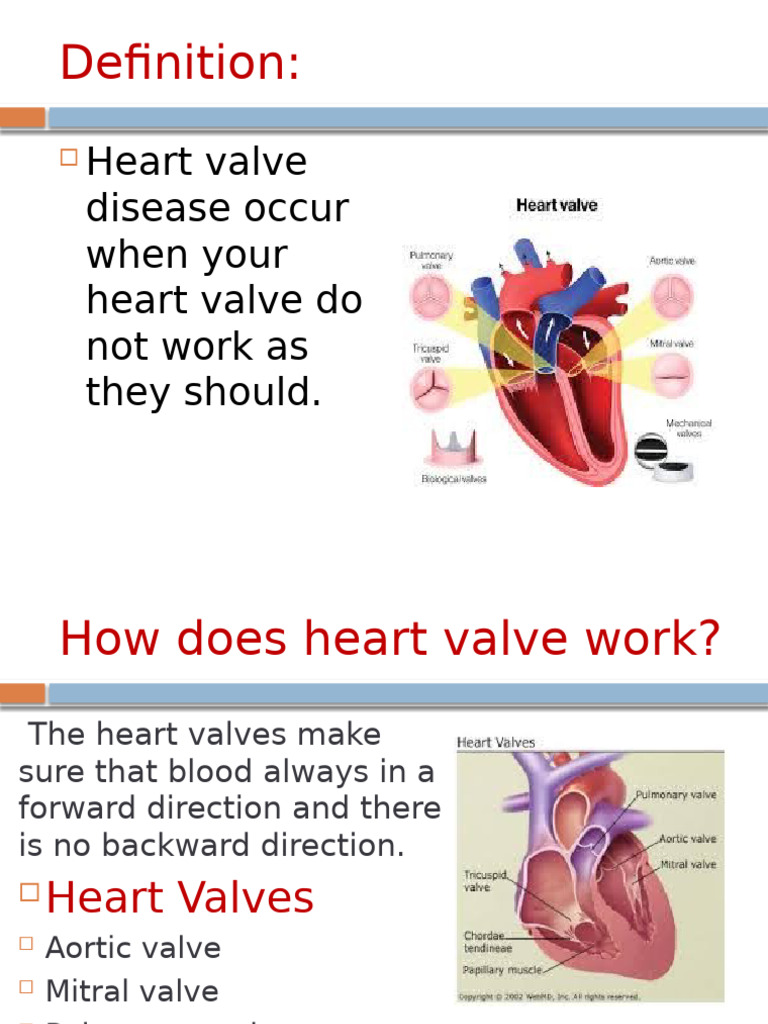 Understanding Heart Valve Disease | PDF | Heart Valve | Heart
