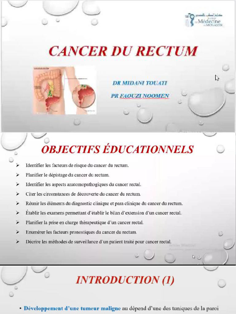 3. Cancer du rectum | PDF