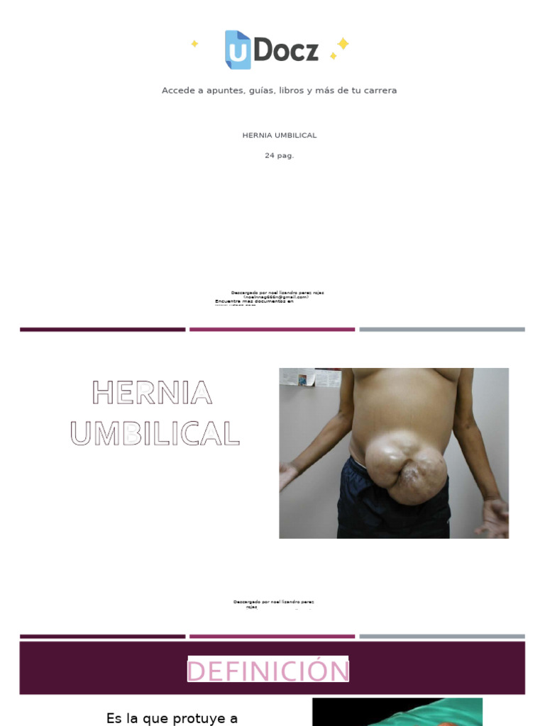 Hernia Umbilical 107930 Downloadable 3344379 | PDF | Especialidades ...