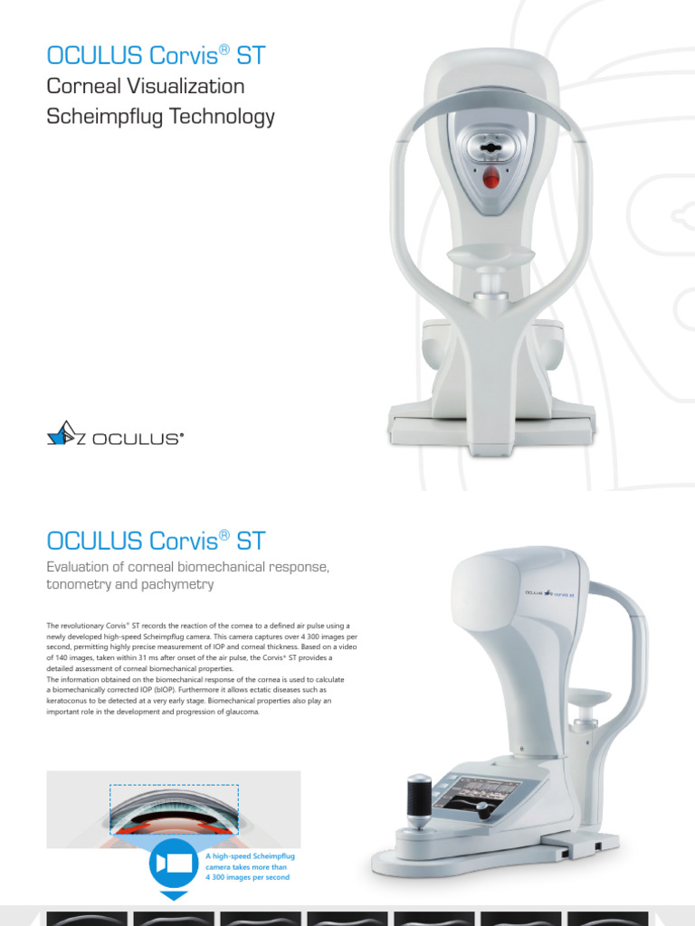 corvis_st | PDF | Glaucoma | Cornea