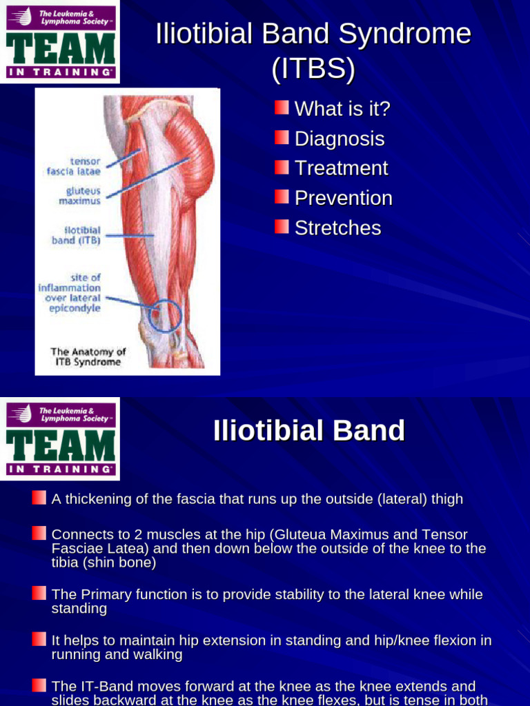 Iliotibialbandsyndromeitbs 12950484155493 Phpapp02 | PDF | Anatomical ...