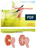 HYDRONEPHROSIS