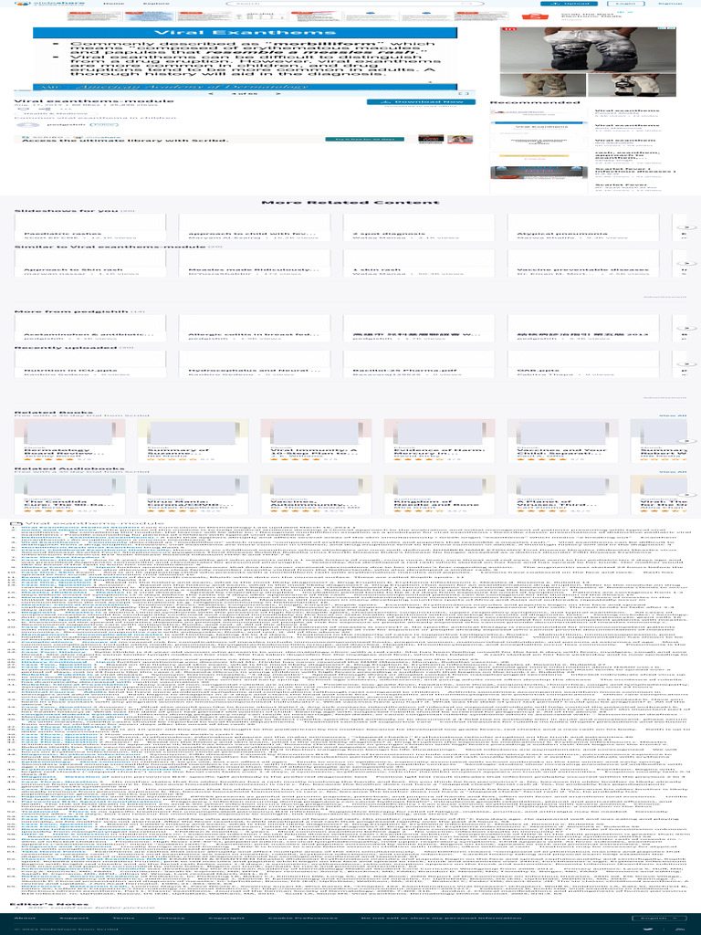 Viral Exanthems Pdf Measles Health Sciences