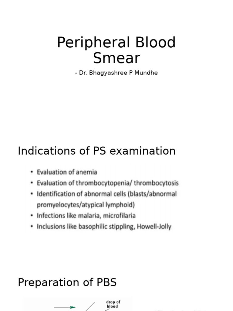 Peripheral Blood Smear Examination Guide | PDF