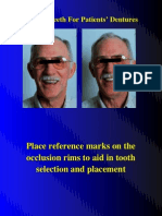 7.2. Complete Denture