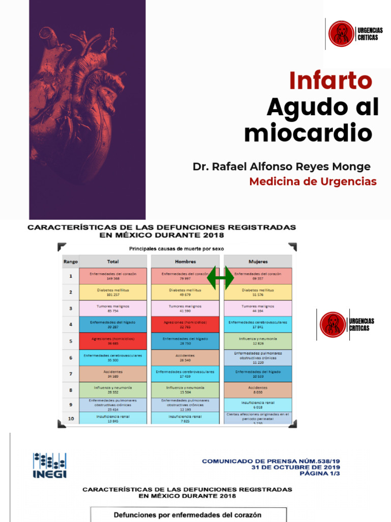 Infarto Agudo de Miocardio | PDF | Electrocardiografia | Infarto de ...