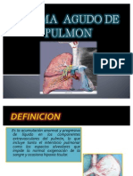 Edema Agudo de Pulmón