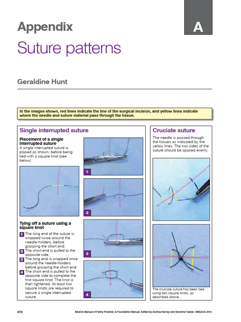 9781910443149.app1 | PDF | Surgical Suture | Surgery