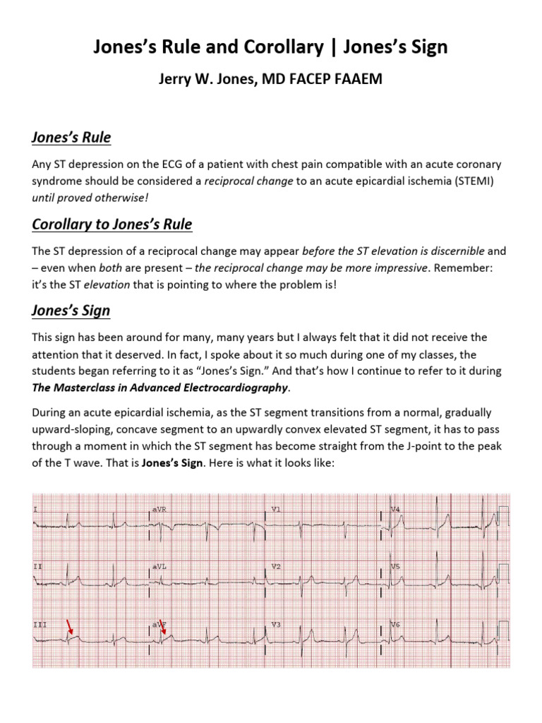 Understanding Jones's Sign in ECG | PDF | Electrocardiography ...