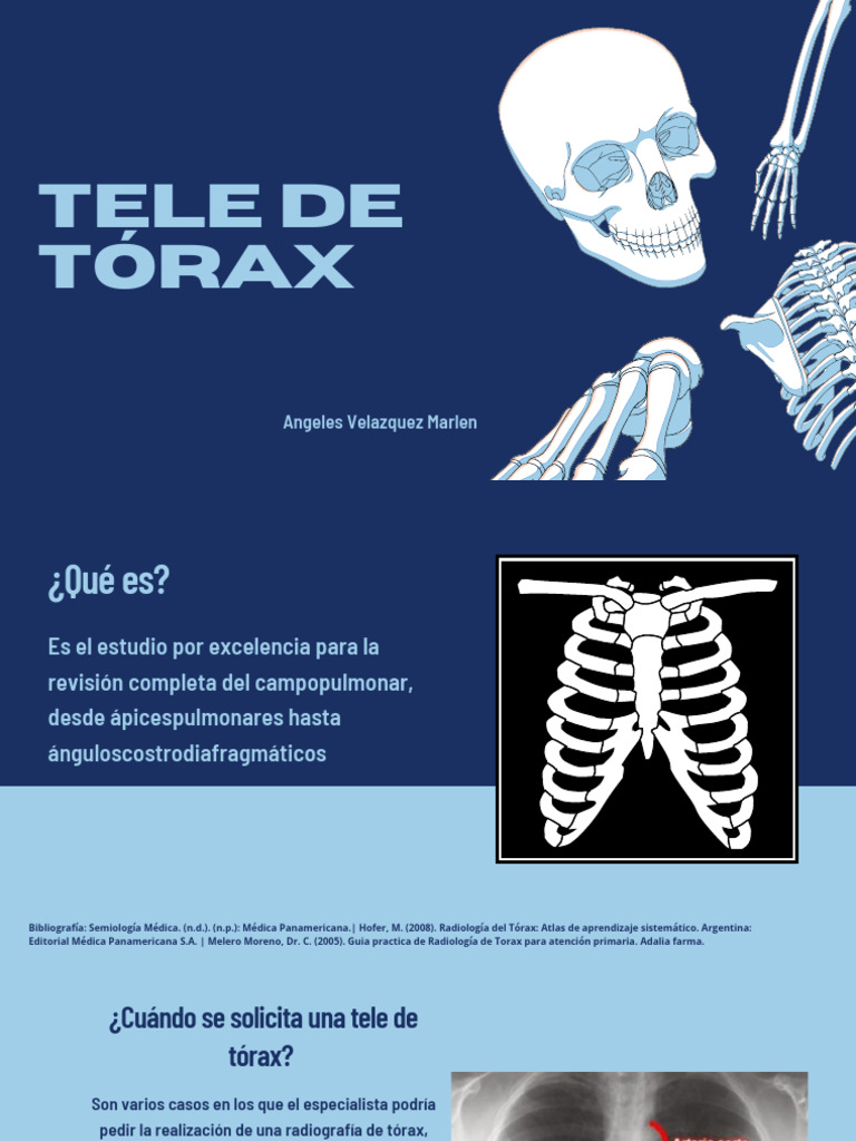 Guía Completa de Tele de Tórax | PDF | Tórax | Radiología