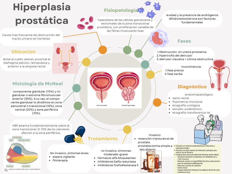 Hiperplasia Prostática | PDF | Especialidades Medicas | Medicina CLINICA
