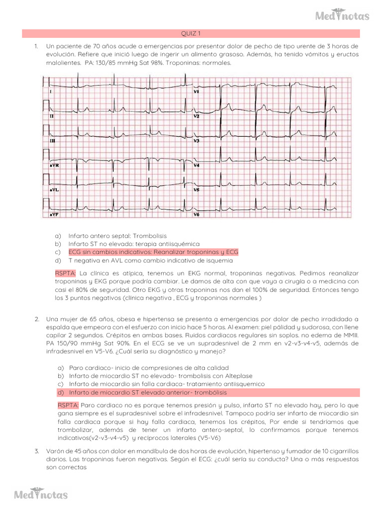 Binder 1 | PDF | Infarto de miocardio | Electrocardiografia