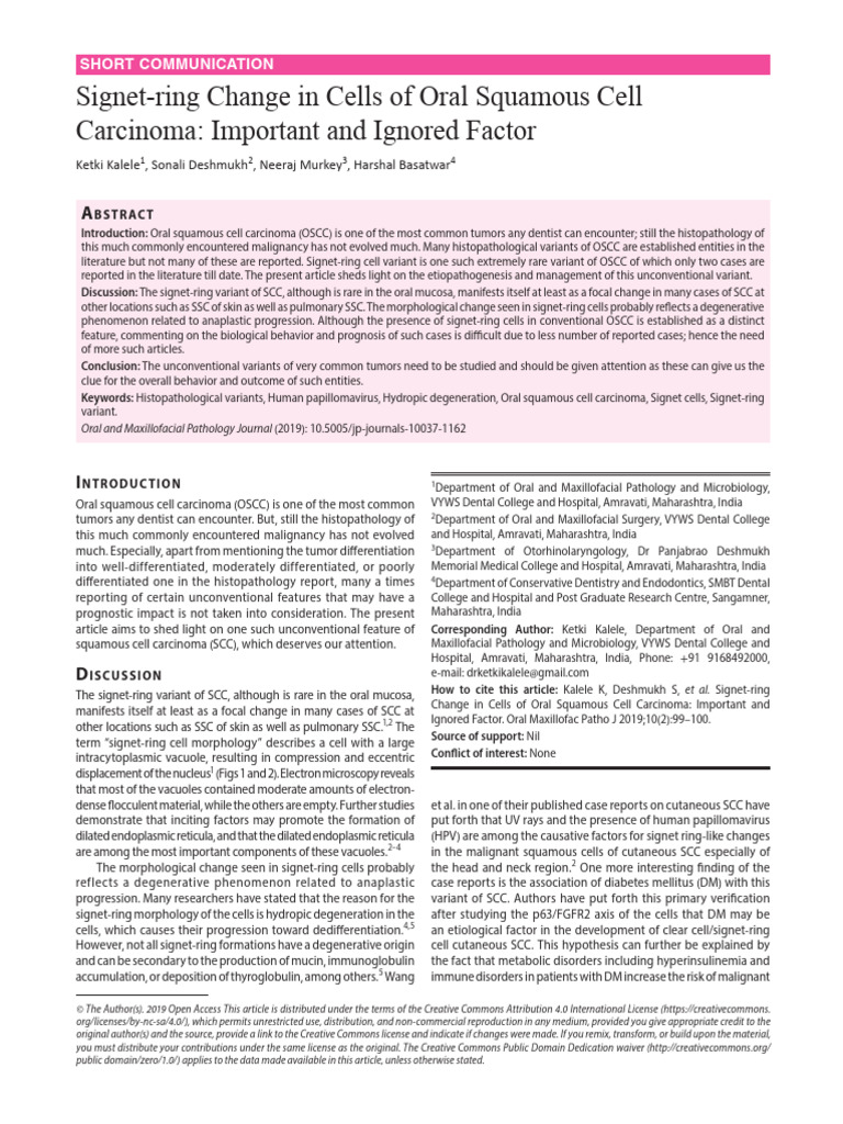 Signet-Ring Cells in Oral Cancer | PDF | Squamous Cell Carcinoma ...