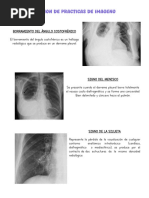 Signo de Jobert Radiológico y Clínico Pregunta Doctor Tata | PDF