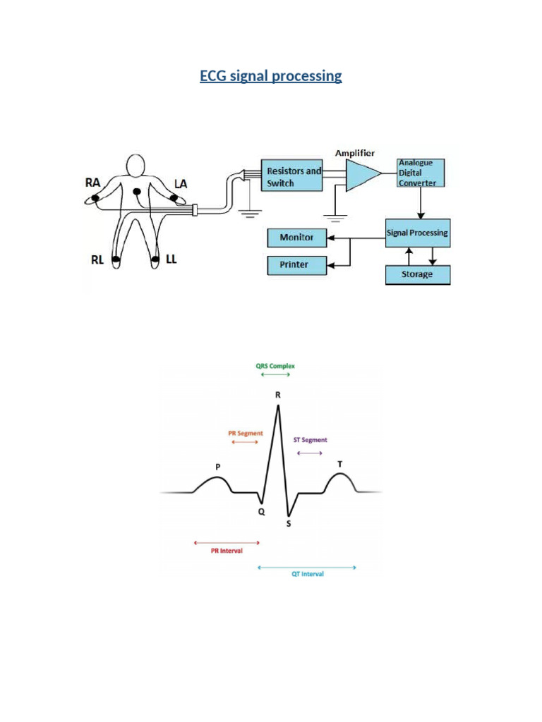 ECG Signal Processing | PDF