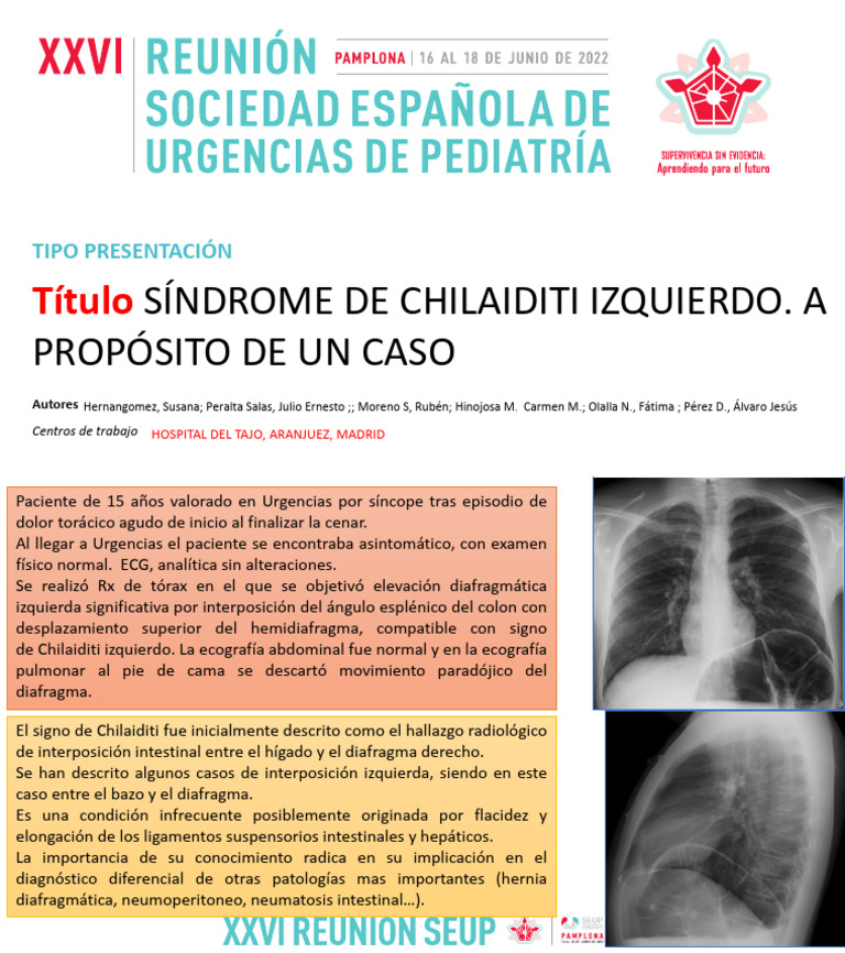 PD41 | PDF