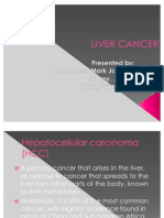 Liver Cancer: Primary Cancer of the Liver