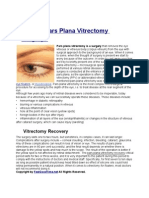 What is Pars Plana Vitrectomy Surgery?