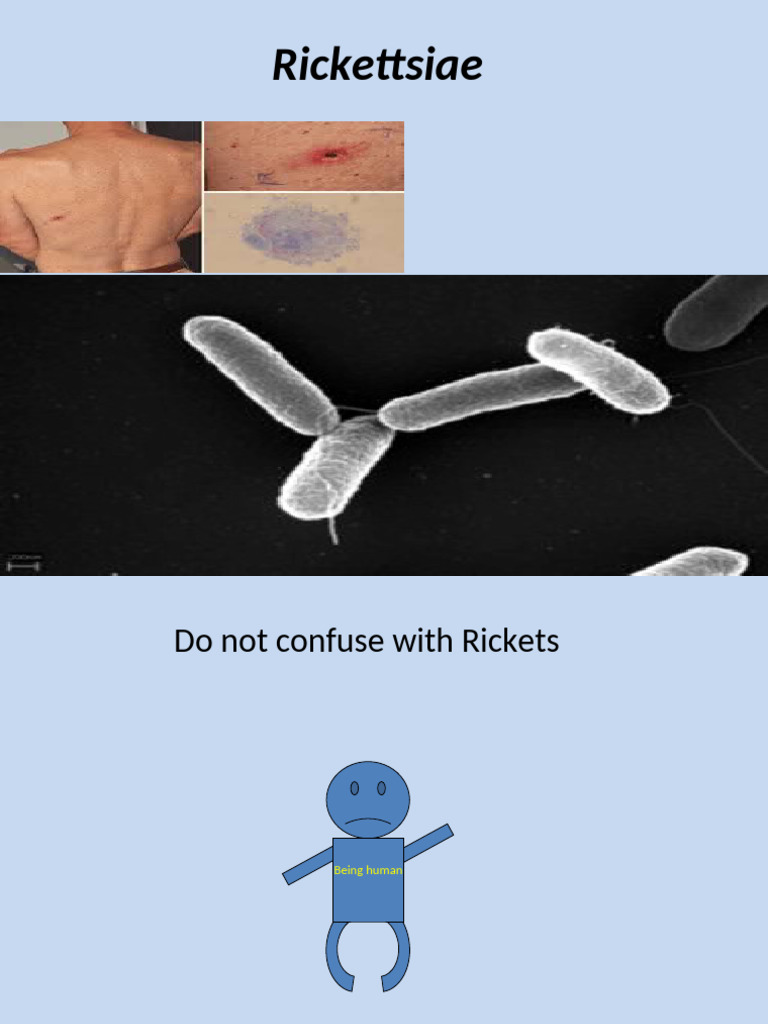 Rickettsial Diseases Overview | PDF | Infection | Medical Specialties