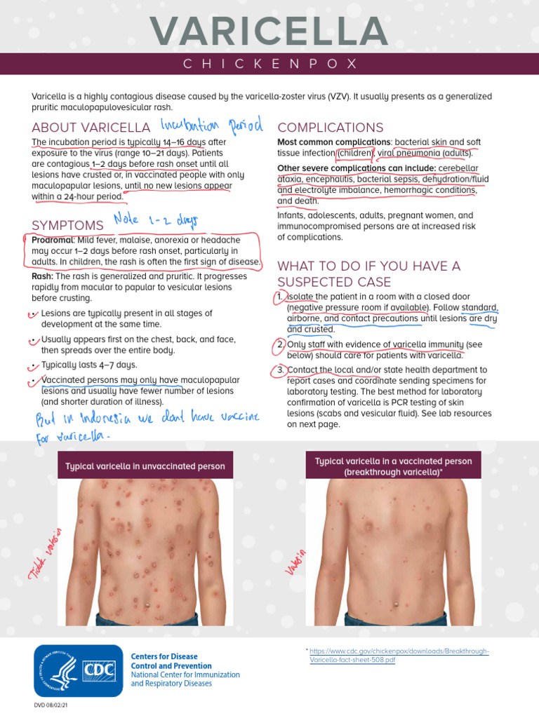 Understanding Varicella (Chickenpox) | PDF | Microbiology | Pediatrics
