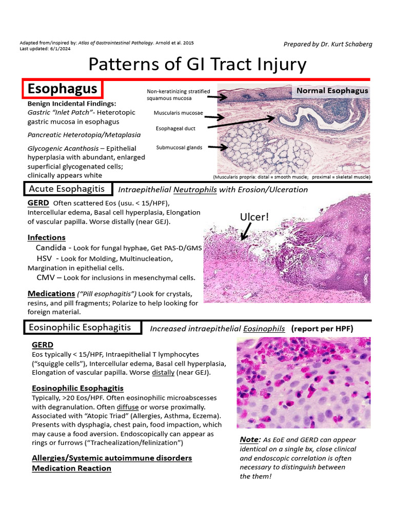 GI Tract Injury Patterns Overview | PDF | Ulcerative Colitis | Crohn's ...