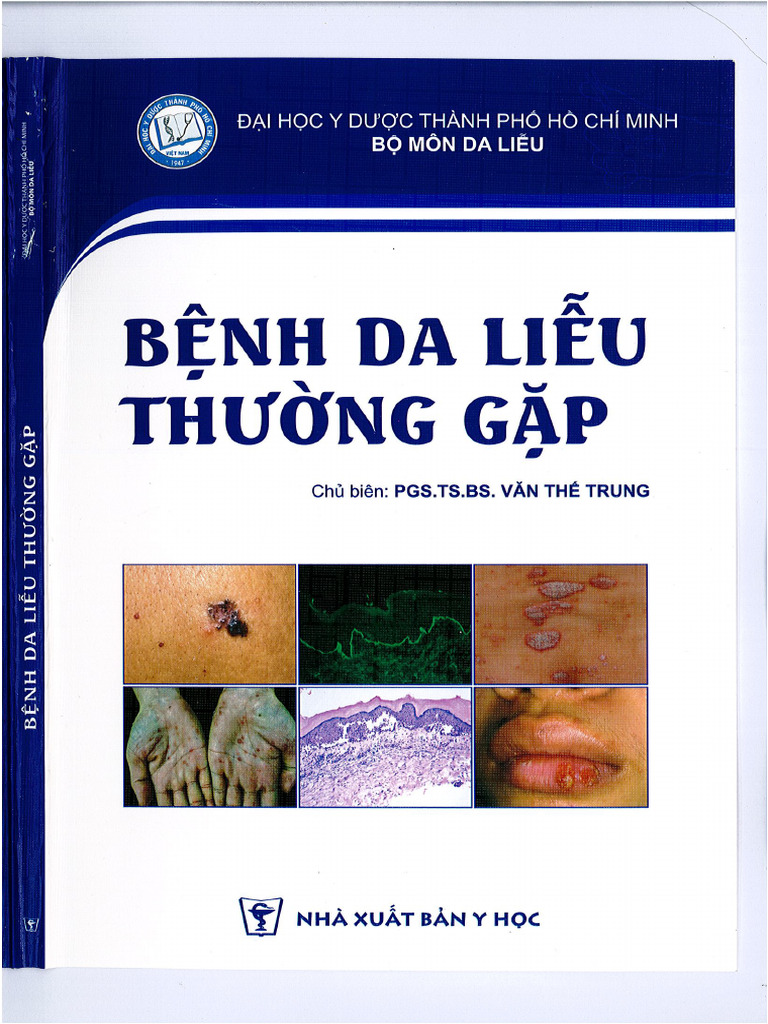 Bệnh da liễu thường gặp | PDF