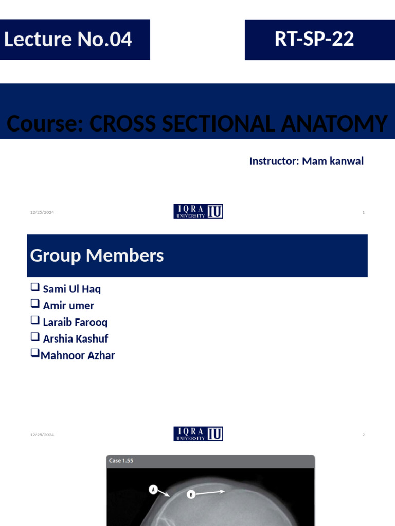 Cross-Sectional Anatomy of the Skull | PDF | Skull | Musculoskeletal System