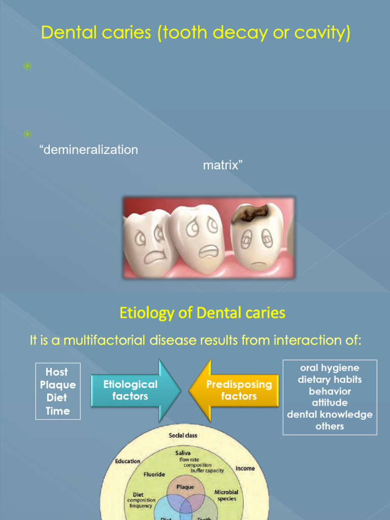 Dental Caries Development | PDF | Human Tooth | Tooth Enamel