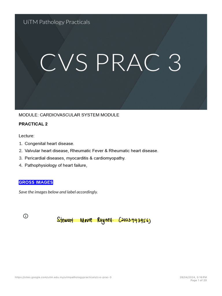 CVS Practical 3: Heart Disease Overview | PDF | Heart Valve ...