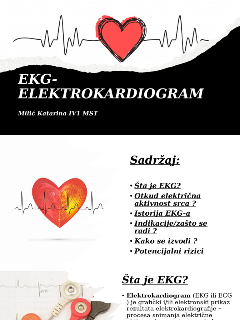 Ekg-Elektrokardiogram: Milić Katarina IV1 MST | PDF