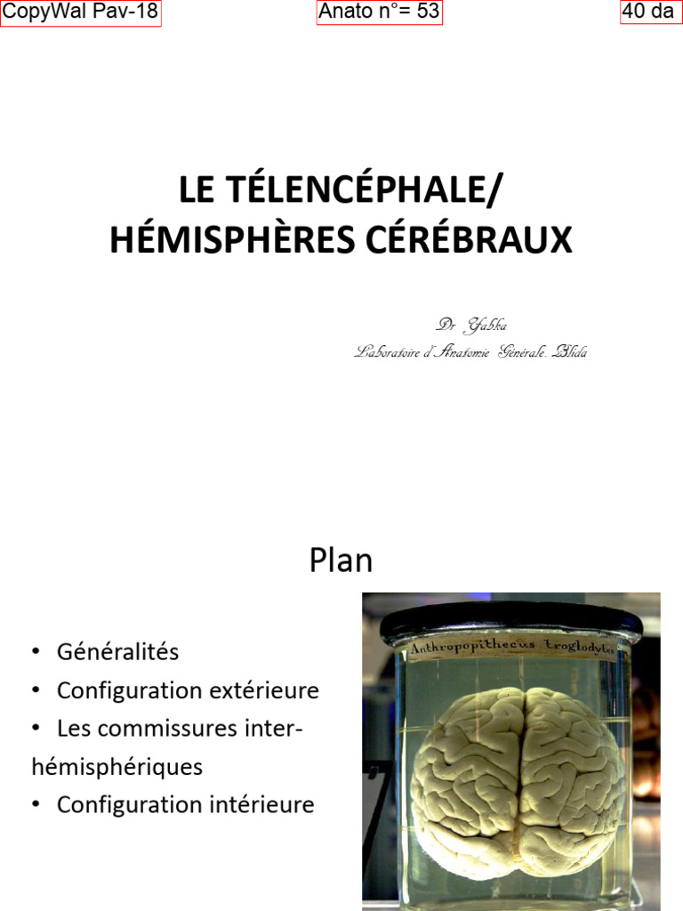Anatomie du Télencéphale et Lobes Cérébraux | PDF | Circonvolution ...