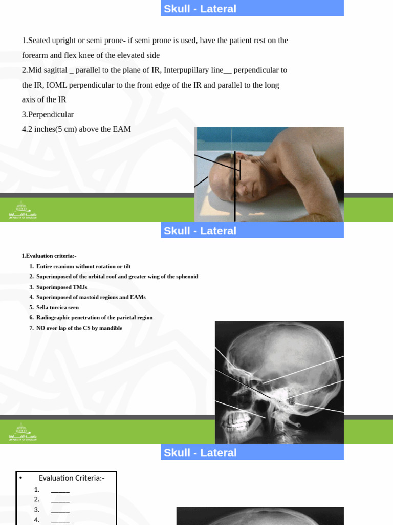Skull Radiography (2) | PDF | Skull | Cerebrospinal Fluid