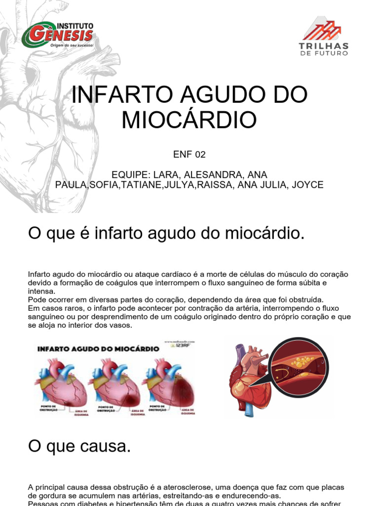 Infarto Agudo do Miocárdio: Causas e Tratamentos | PDF | Infarto do ...