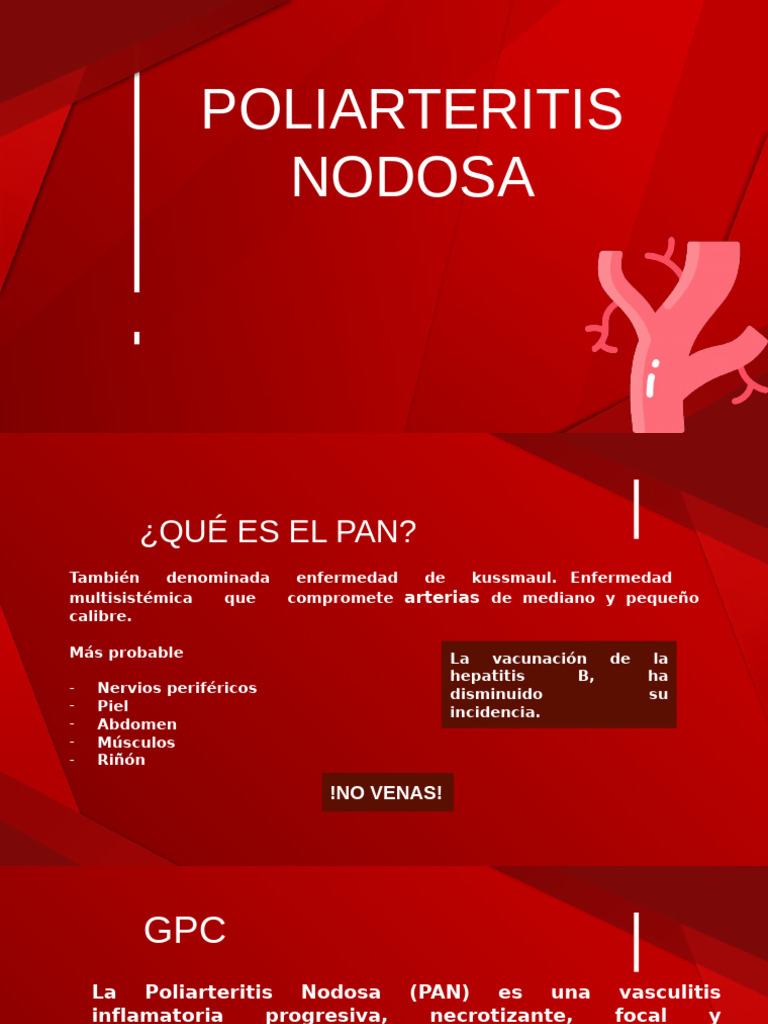 Poliarteritis Nodosa | PDF | Medicina CLINICA | Enfermedades y trastornos