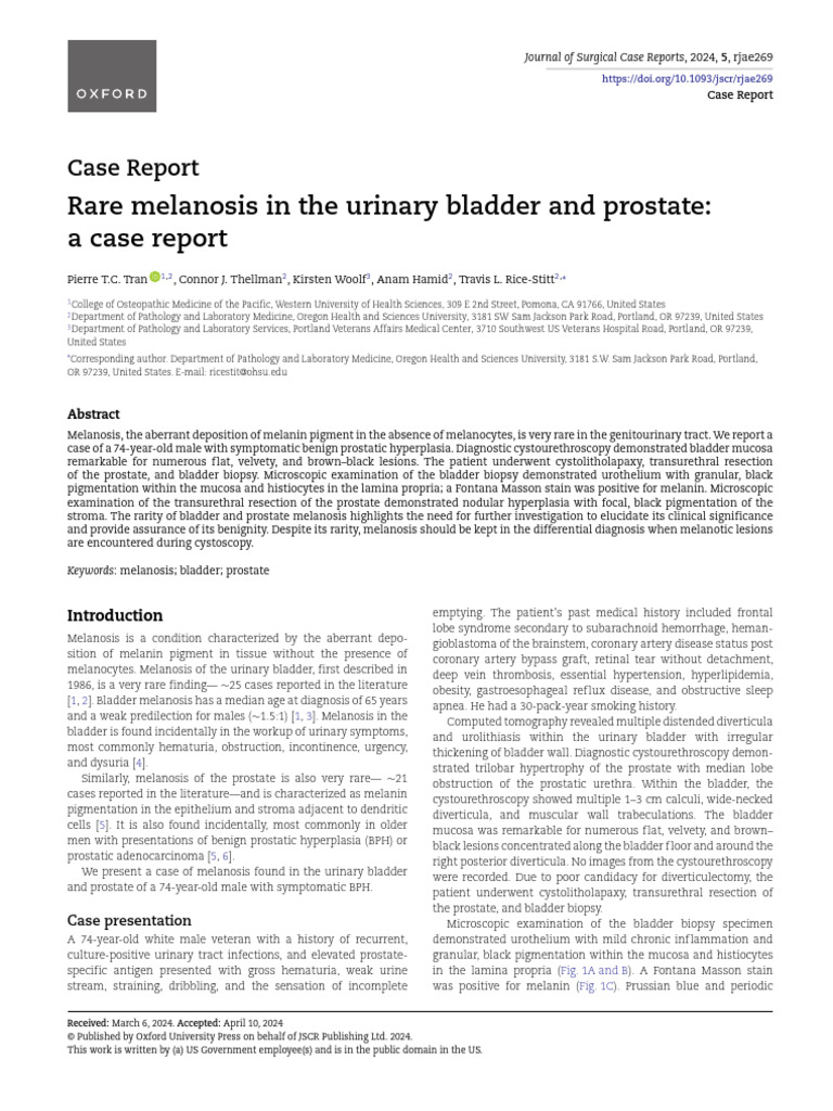 Melanosis pdf prostate melanoma