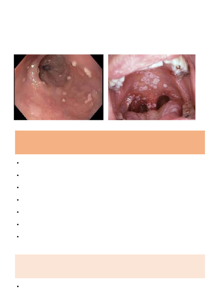 10. Pathophysiology of invasive fungal infection (1) | PDF ...