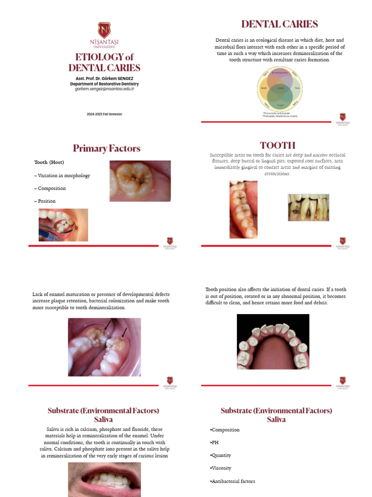2.ETIOLOGY students | PDF | Tooth Enamel | Biofilm