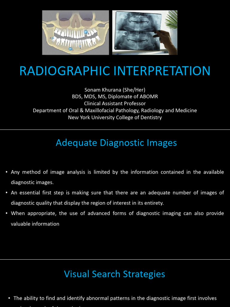 Radiographic Interpretation in Dentistry | PDF | Human Head And Neck ...