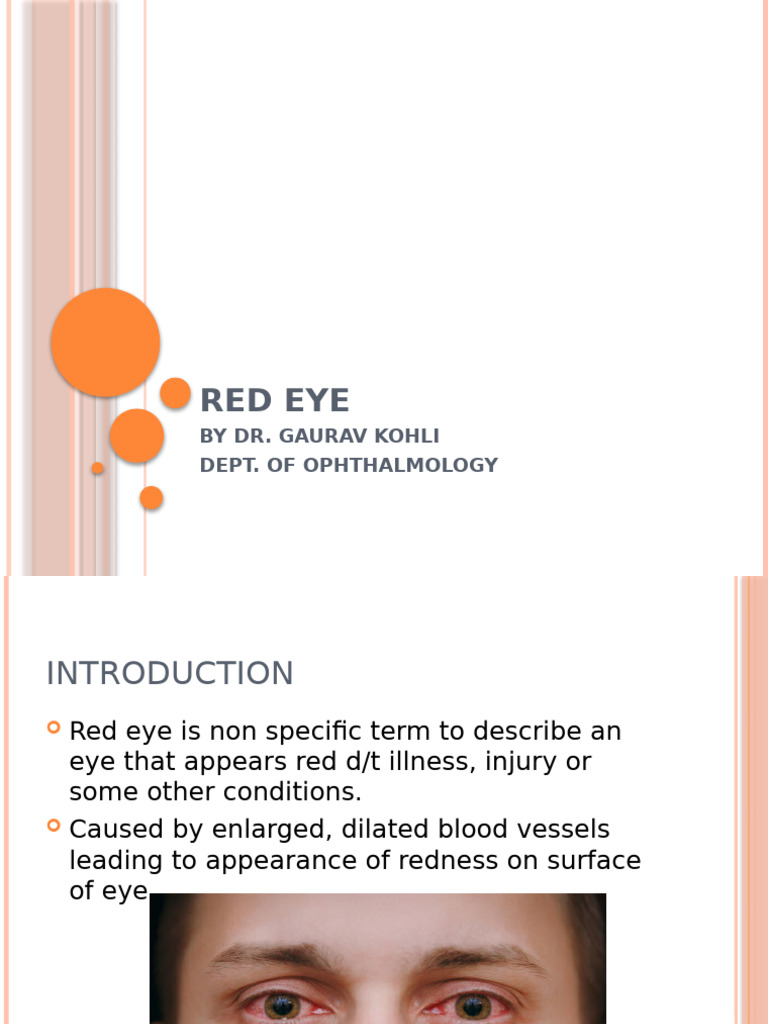 RED EYE | PDF | Glaucoma | Clinical Medicine