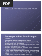 Download Foto Rontgen Fraktur by Ool Uul SN81032069 doc pdf