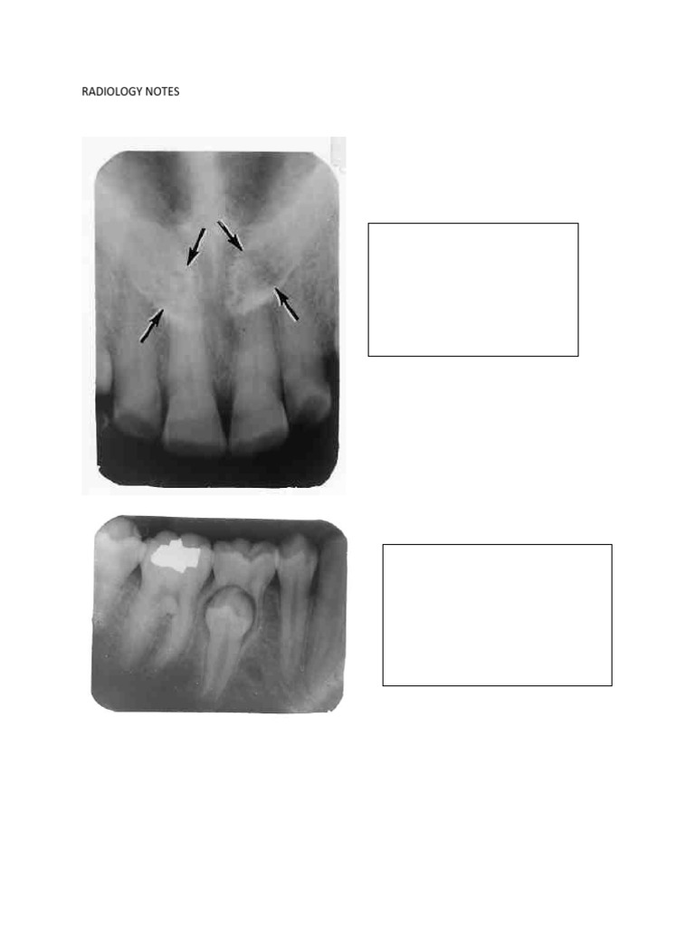 RADIOLOGY NOTES | PDF | Human Tooth | Dentistry