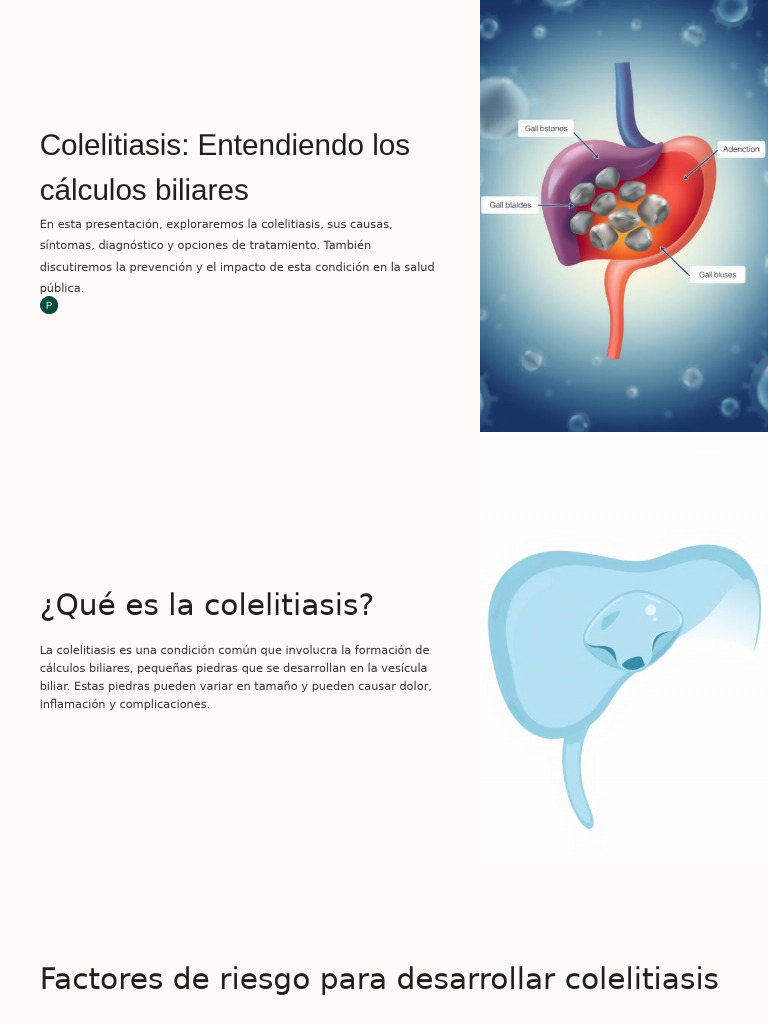 Colelitiasis-Entendiendo-los-calculos-biliares | PDF | Bilis | Causas ...